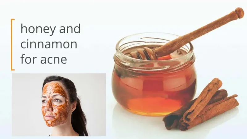 5 things you should follow in winter for skin care treatment