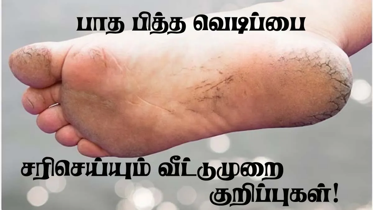 பாத பித்த வெடிப்பை சரி செய்ய வீட்டு முறை டிப்ஸ்!ட்ரை பண்ணிப்பாருங்க!