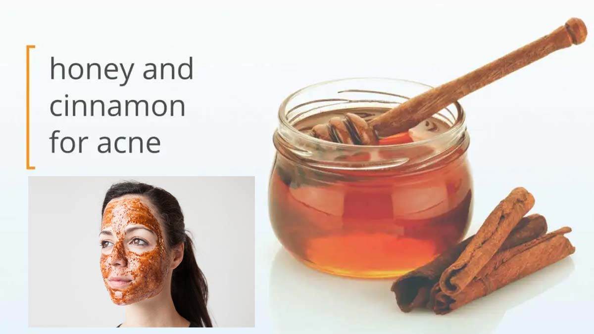 5 things you should follow in winter for skin care treatment